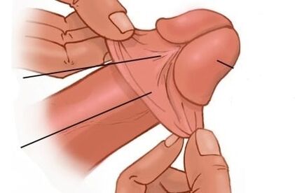 The tip of the penis and its enlargement