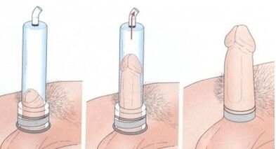 Increase penis size with a pump